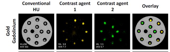 Si-Mohamed, S., Bar-Ness, D., Sigovan, M. et al. “Multicolour imaging with spectral photon-counting CT: a phantom study”. Eur Radiol Exp 2, 34 (2018)