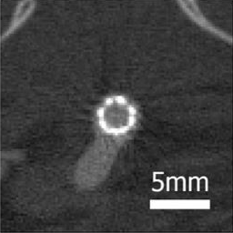 Spectral Photon Counting CT